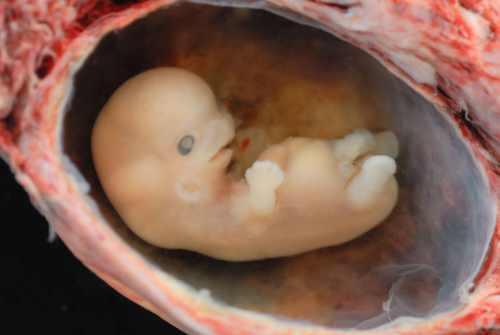 8 недельный эмбрион человека.